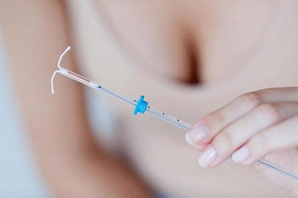 Nên tháo vòng tránh thai khi gặp một số tác dụng phụ như chảy máu hay đau dữ dội