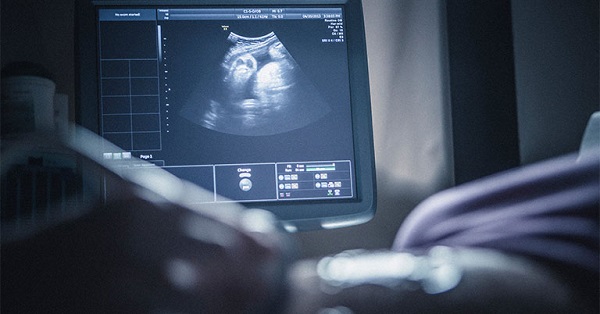 Siêu âm không thấy thai có thể do hiện tượng mang thai ngoài tử cung